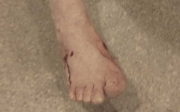 Appeal after dog mauls cat and its owner