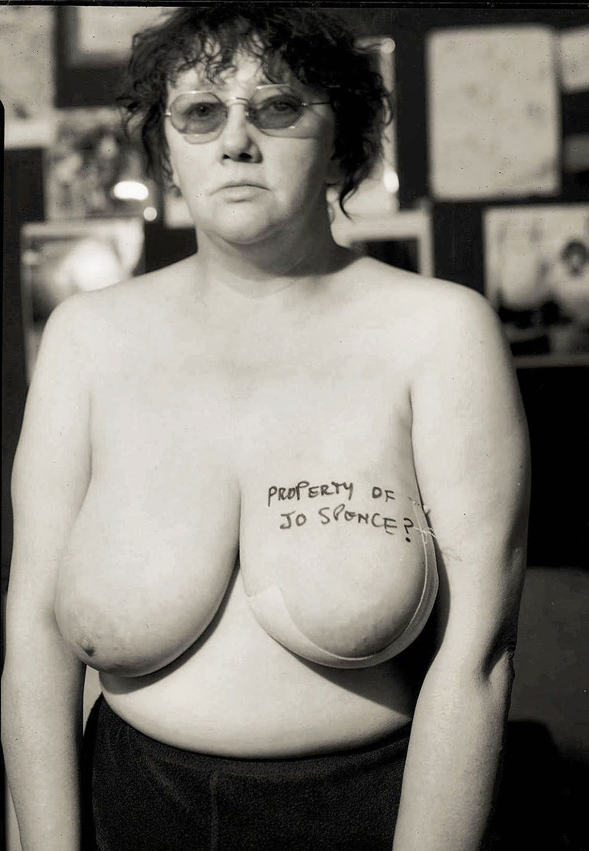 A Picture of Health by Jo Spence © The Estate of Jo Spence. Courtesy Richard Saltoun Gallery