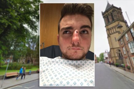 York man left in a pool of his own blood after attack near the Minster