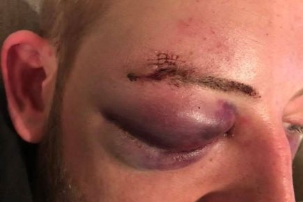 Gang attack leaves York man with serious injuries