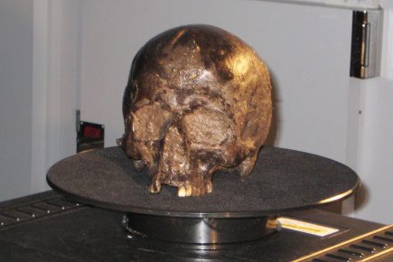 Found in York, a brain that is more than 2,600 years old reveals its secrets