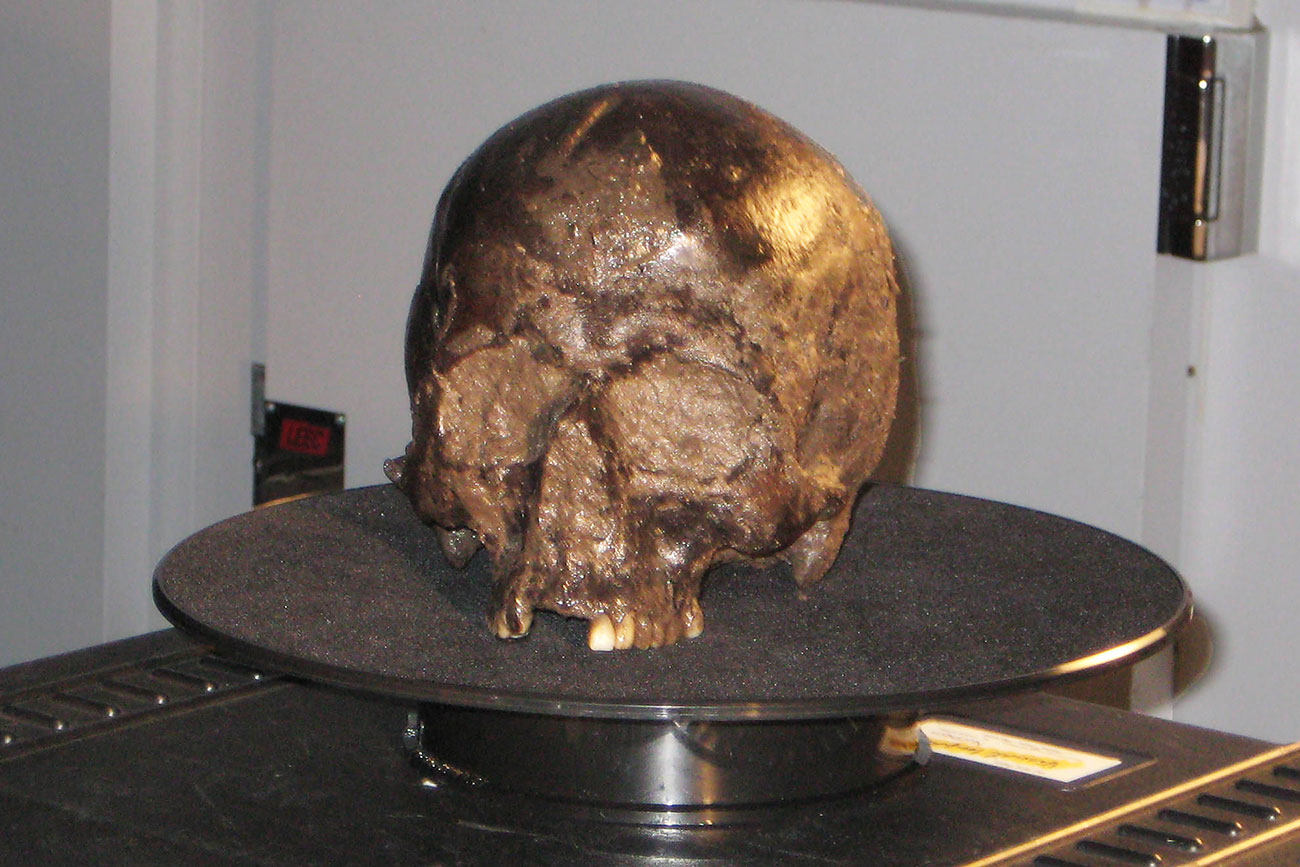 Found in York, a brain that is more than 2,600 years old reveals its secrets