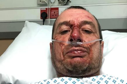 Police seek hit-and-run driver who left two cyclists in hospital – one with a broken back