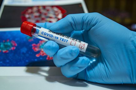 Glitch in test and trace system causes ‘deeply frustrating’ delay in reporting positive York Covid cases