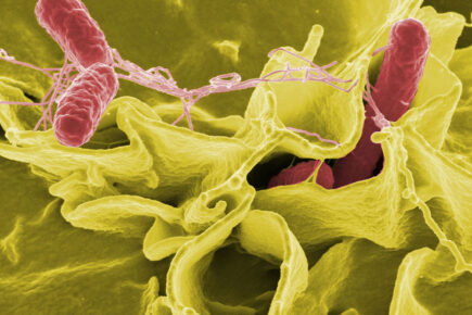 York retailers urged to take action on products linked to salmonella