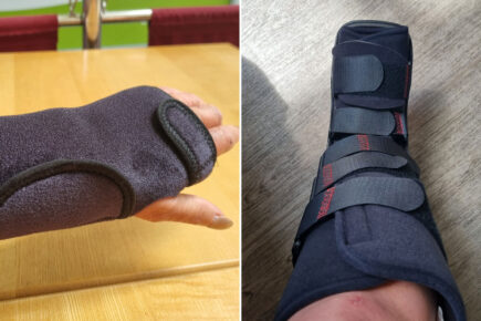 Cyclist breaks her foot and wrist in York hit-and-run – but no one comes to her aid