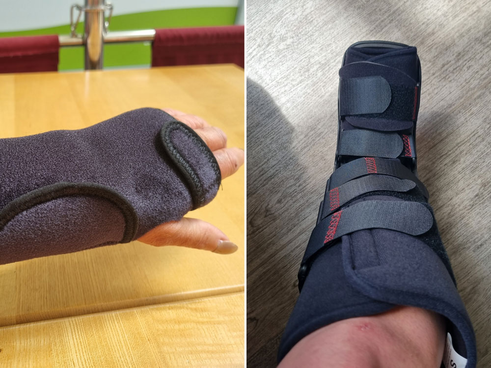 Cyclist breaks her foot and wrist in York hit-and-run – but no one comes to her aid