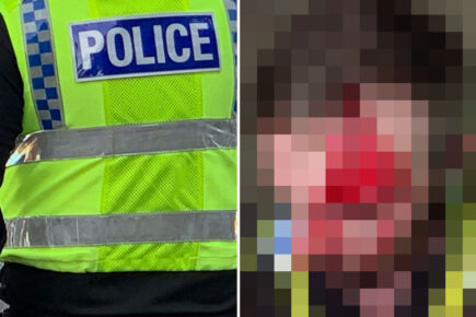 Warning – graphic content: Police release shocking pictures after officer attacked in York