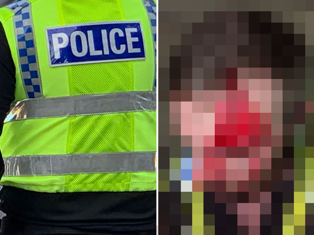 Warning – graphic content: Police release shocking pictures after officer attacked in York