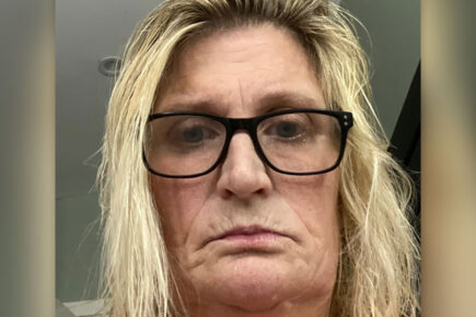 ‘It’s been a living nightmare’: York woman awarded £25K after tooth loss agony