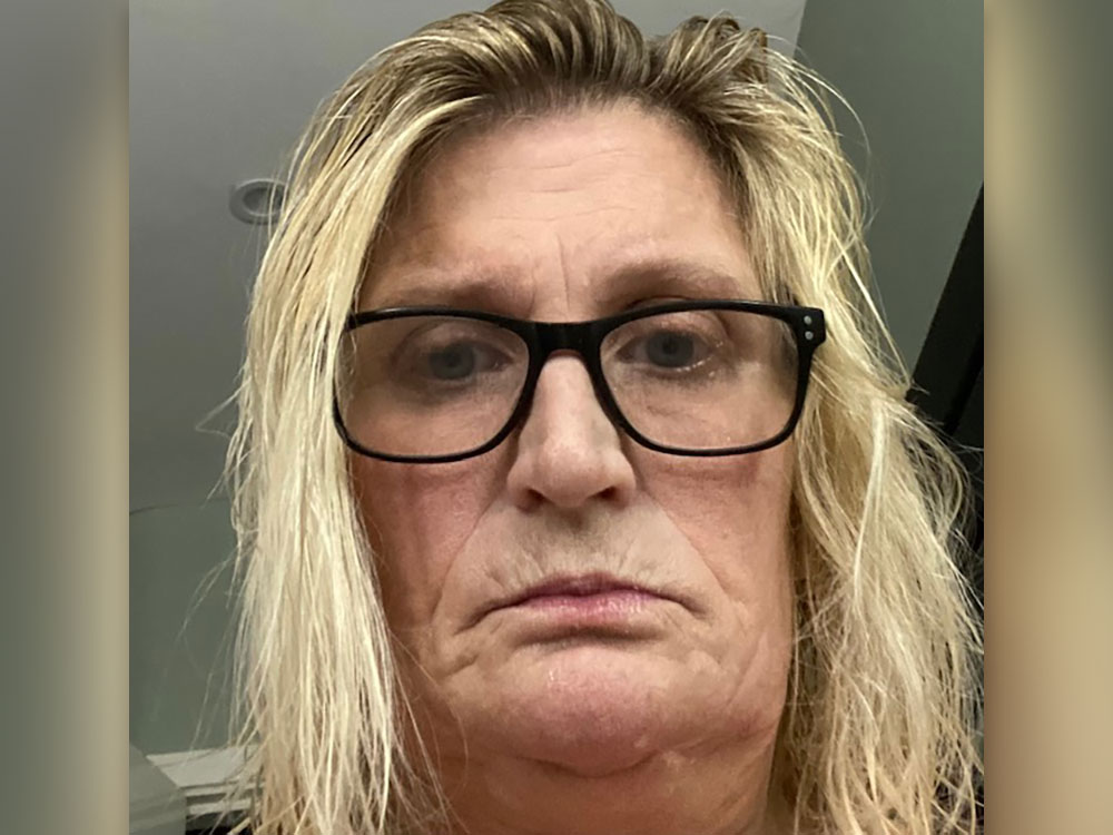‘It’s been a living nightmare’: York woman awarded £25K after tooth loss agony