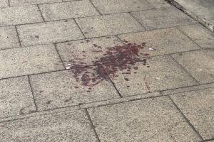 Large bloodstains left on York street following violent incident