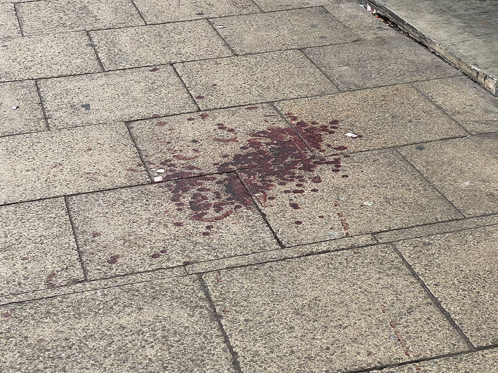 Large bloodstains left on York street following violent incident