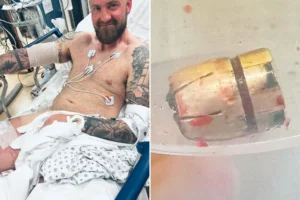 York father ‘lucky to be alive’ after being shot twice by masked gunmen in New York