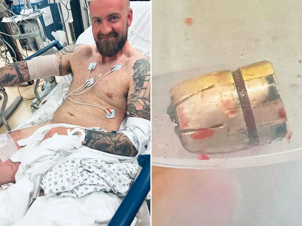 York father ‘lucky to be alive’ after being shot twice by masked gunmen in New York