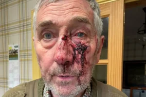 Victim left with shocking injuries after attack by middle-aged cyclist