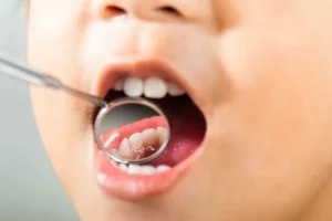 York dentist has NHS spaces for children