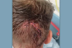 Scarborough teenager locked up for brutal shovel attack