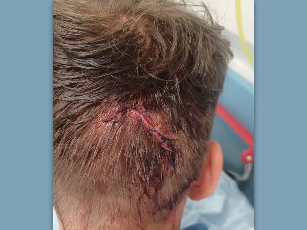 Scarborough teenager locked up for brutal shovel attack