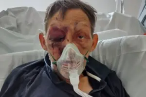York attack victim dies weeks after ‘disgusting’ assault