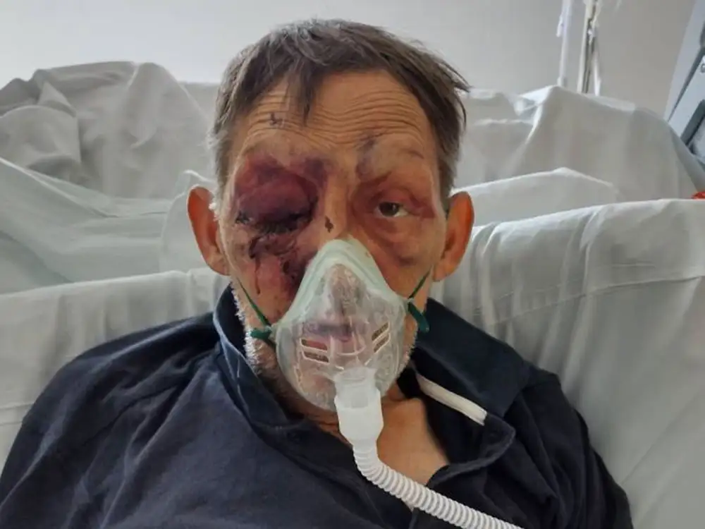 Updated: Vulnerable York man in a coma after ‘disgusting’ riverside attack